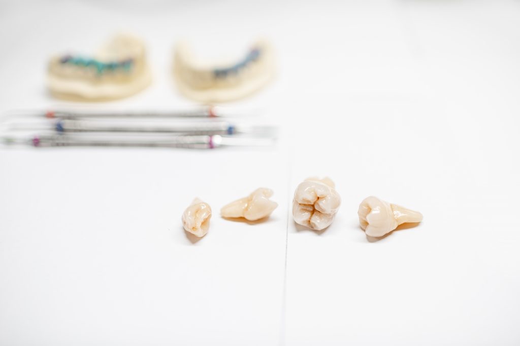 Kanały a trudność w leczeniu zębów
