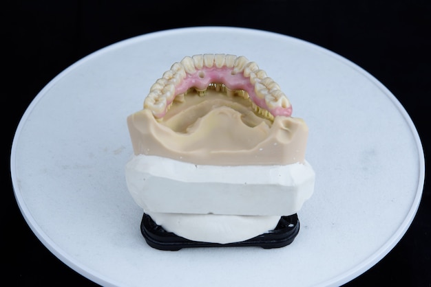 Jak uzyskać protezę zębową refundowaną przez NFZ?