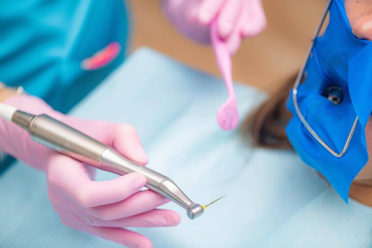 Endodonta czym się zajmuje i kiedy warto się do niego zgłosić?