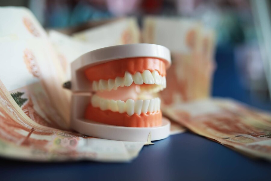 Ile kosztuje górna szczęka na implantach?