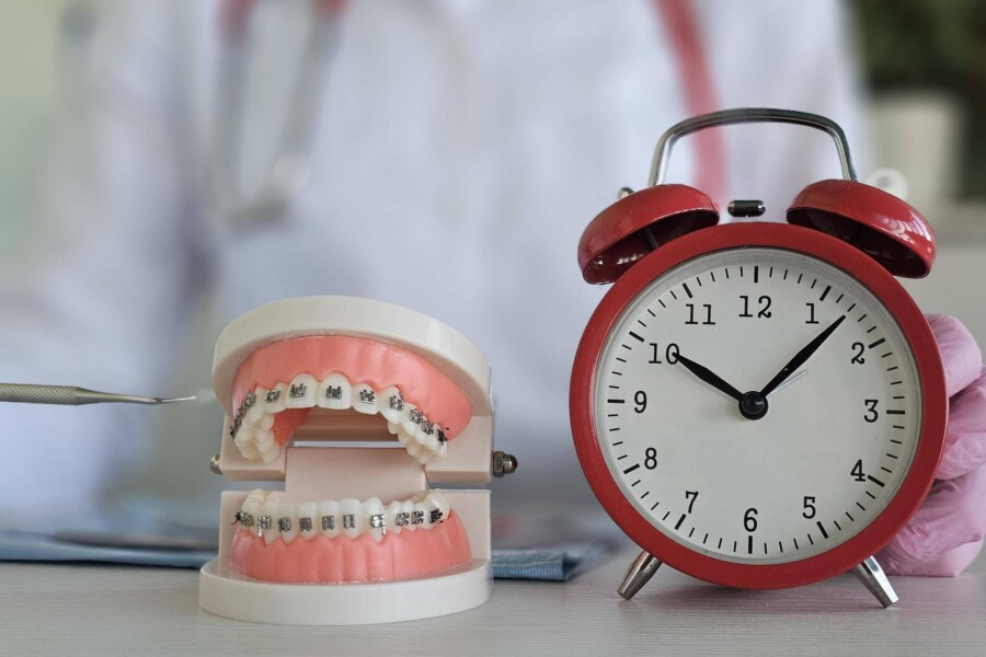 Ile czasu trwa założenie implantu zęba i od czego to zależy?