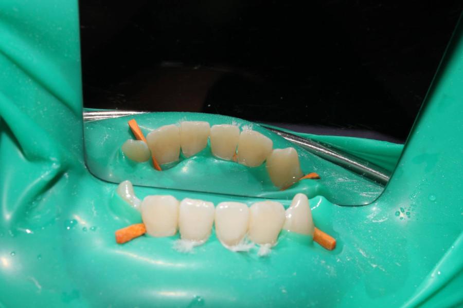 Jak usztywnić ruszający się ząb i kiedy warto zgłosić się do dentysty?