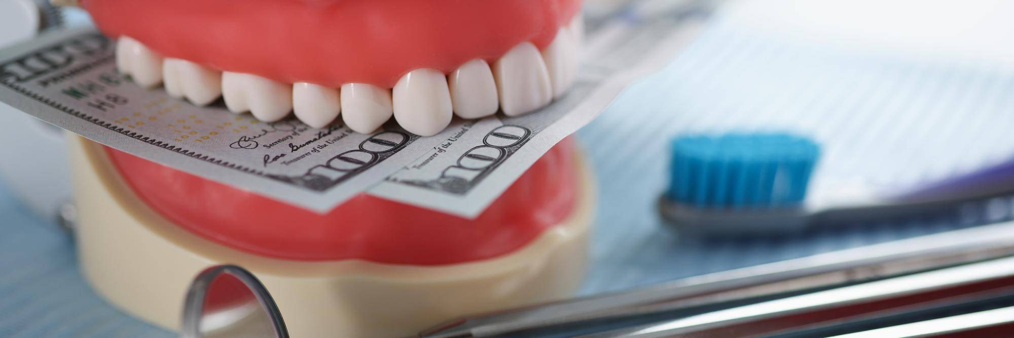 Jaka jest cena implantów zębowych i od czego zależy?