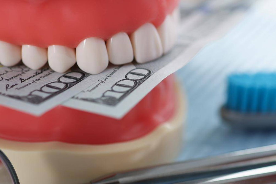 Od czego zależy koszt implantów zębowych?